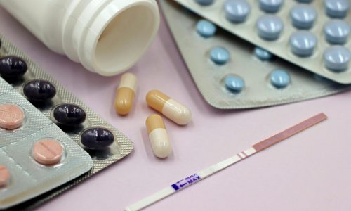 Contraception : les alternatives à la pilule